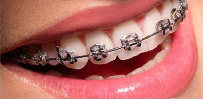 dentalna ortodontska stomatologija